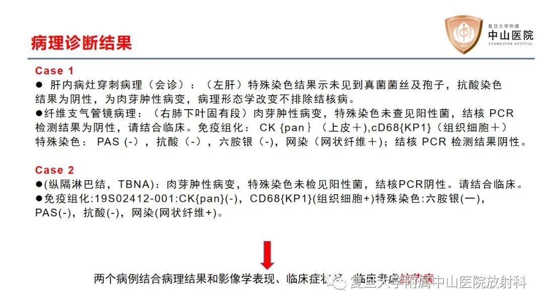影像PPT - 【病例】结节病2例影像-5