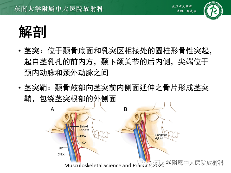 影像PPT - 【PPT】茎突综合征-19