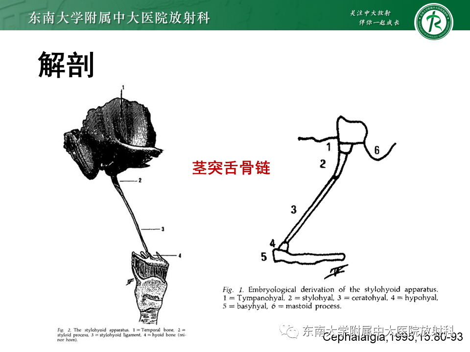 影像PPT - 【PPT】茎突综合征-21