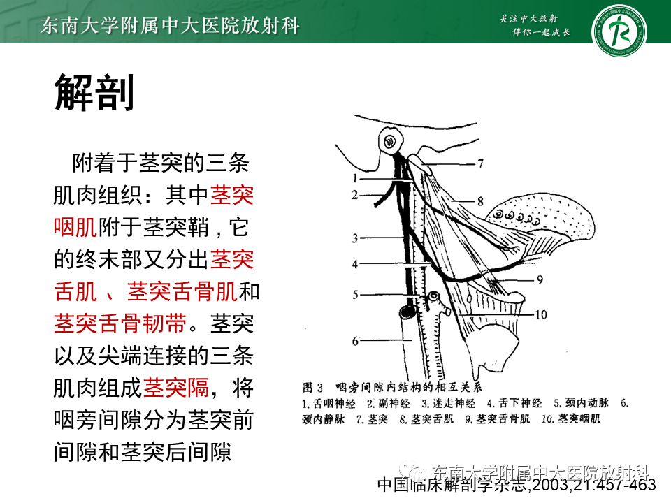 影像PPT - 【PPT】茎突综合征-23