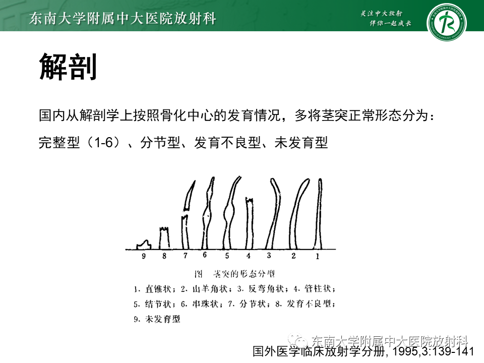 影像PPT - 【PPT】茎突综合征-25