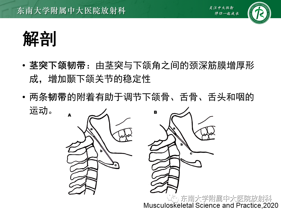 影像PPT - 【PPT】茎突综合征-22