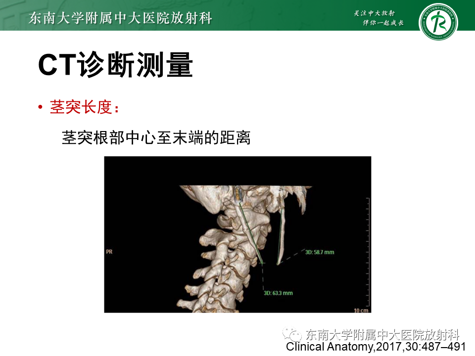 影像PPT - 【PPT】茎突综合征-33