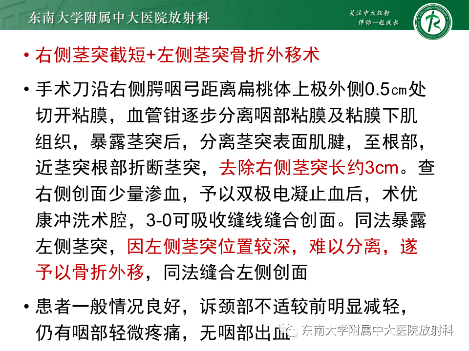 影像PPT - 【PPT】茎突综合征-38