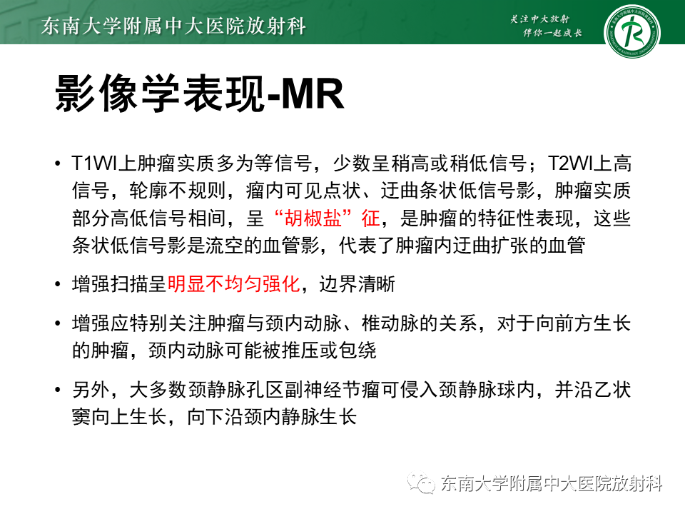 影像PPT - 【PPT】颈静脉球瘤-13 影像PPT - 【PPT】颈静脉球瘤-13