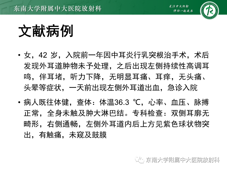 影像PPT - 【PPT】颈静脉球瘤-16 影像PPT - 【PPT】颈静脉球瘤-16
