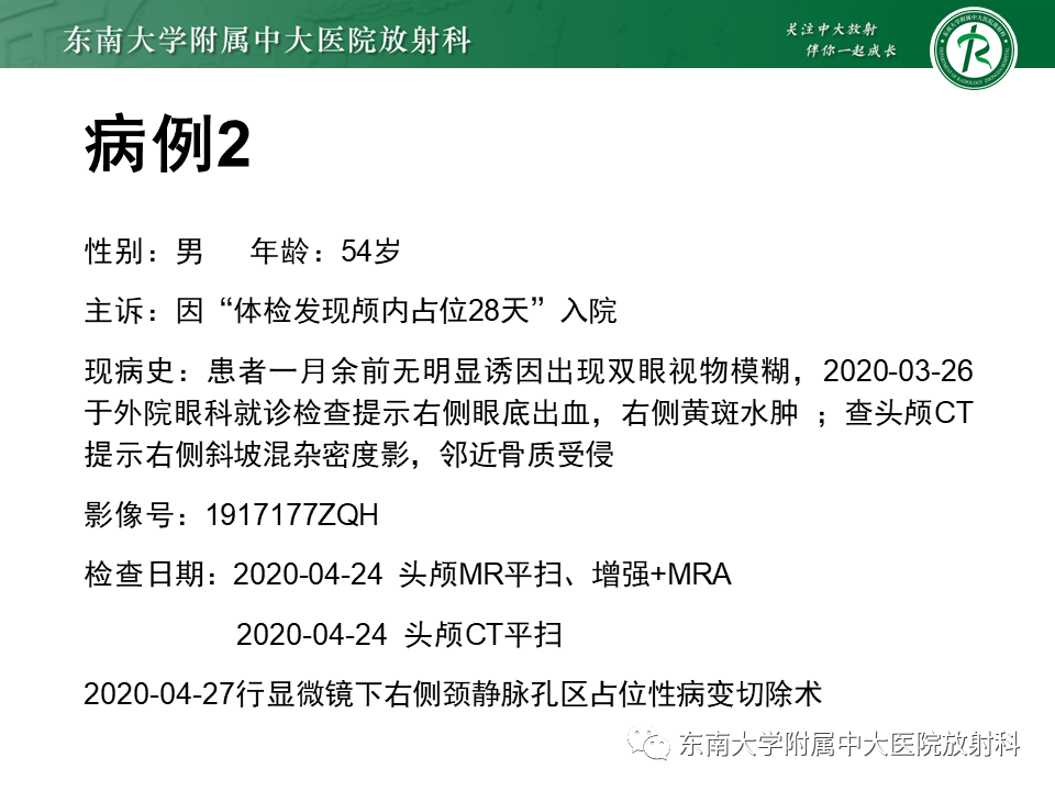 影像PPT - 【PPT】颈静脉球瘤-22 影像PPT - 【PPT】颈静脉球瘤-22