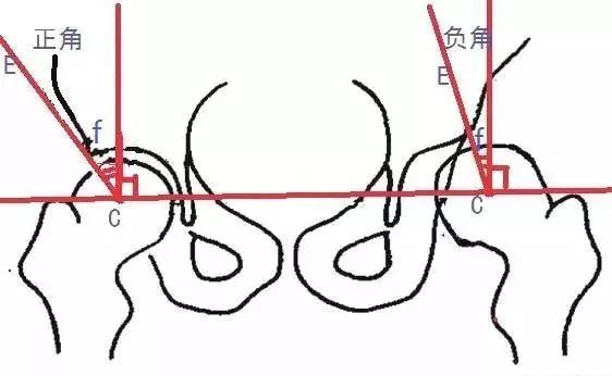 影像PPT - 骨盆X线解剖详解-6