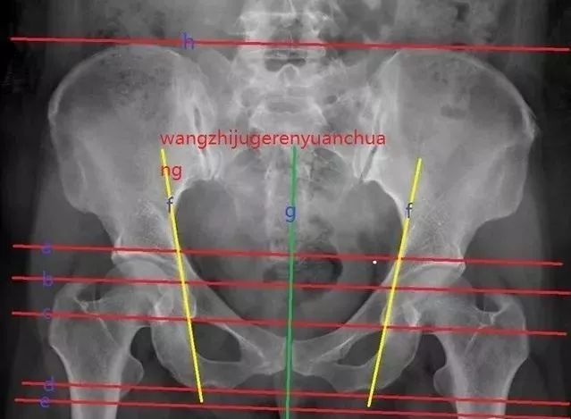 影像PPT - 骨盆X线解剖详解-1