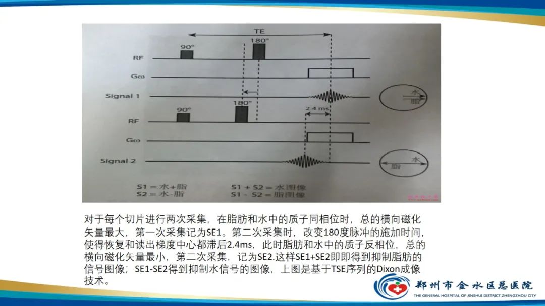 影像PPT - 【PPT】磁共振化学位移成像—水脂分离技术原理及应用浅述-12