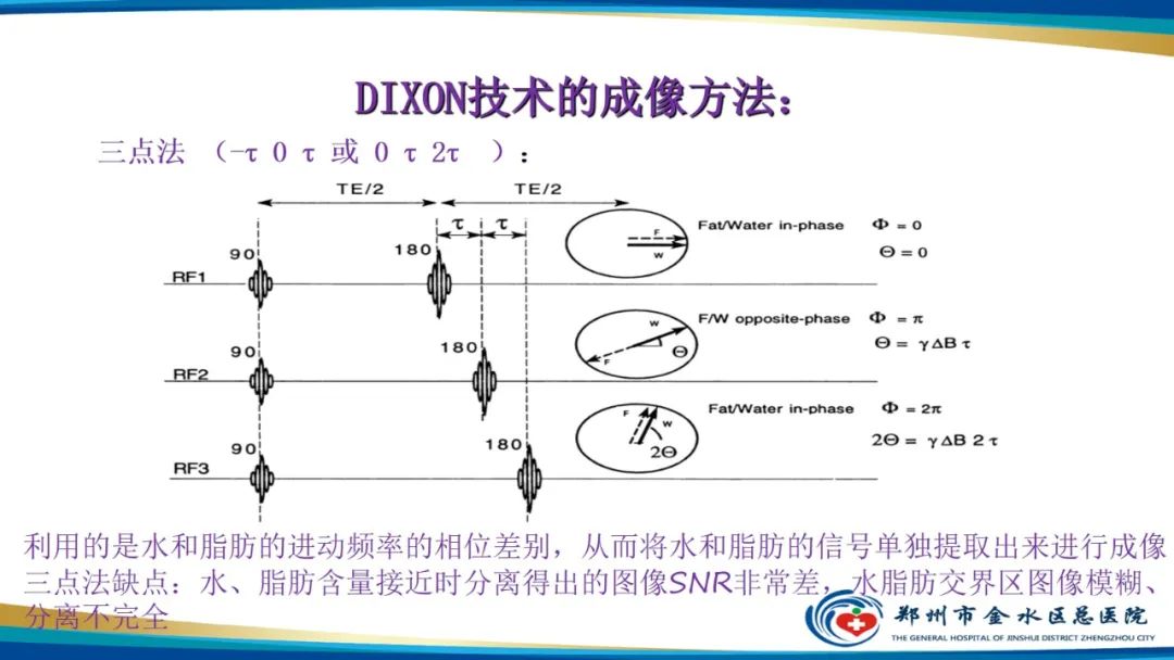 影像PPT - 【PPT】磁共振化学位移成像—水脂分离技术原理及应用浅述-14