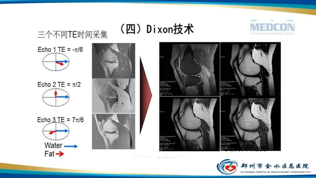 影像PPT - 【PPT】磁共振化学位移成像—水脂分离技术原理及应用浅述-16