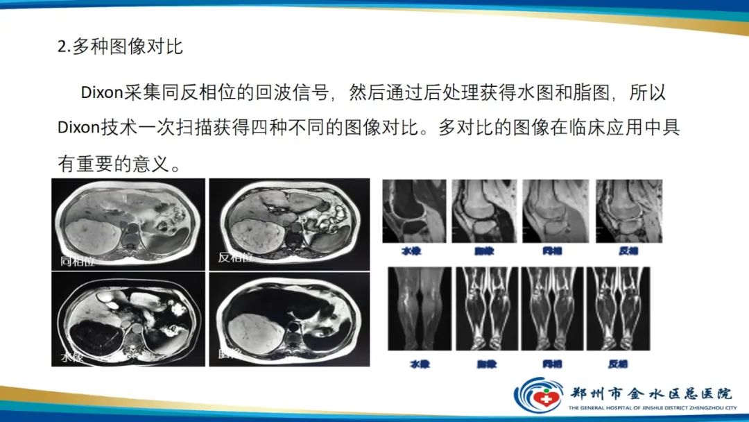 影像PPT - 【PPT】磁共振化学位移成像—水脂分离技术原理及应用浅述-18