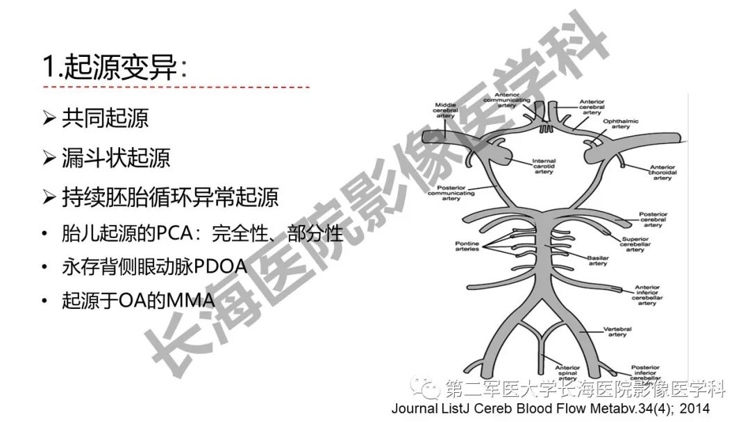 影像PPT - 【PPT】脑供血动脉常见变异-7