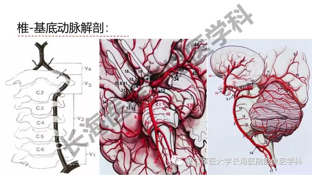 影像PPT - 【PPT】脑供血动脉常见变异-2