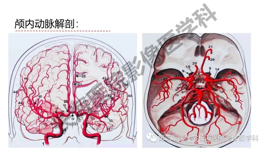 影像PPT - 【PPT】脑供血动脉常见变异-3