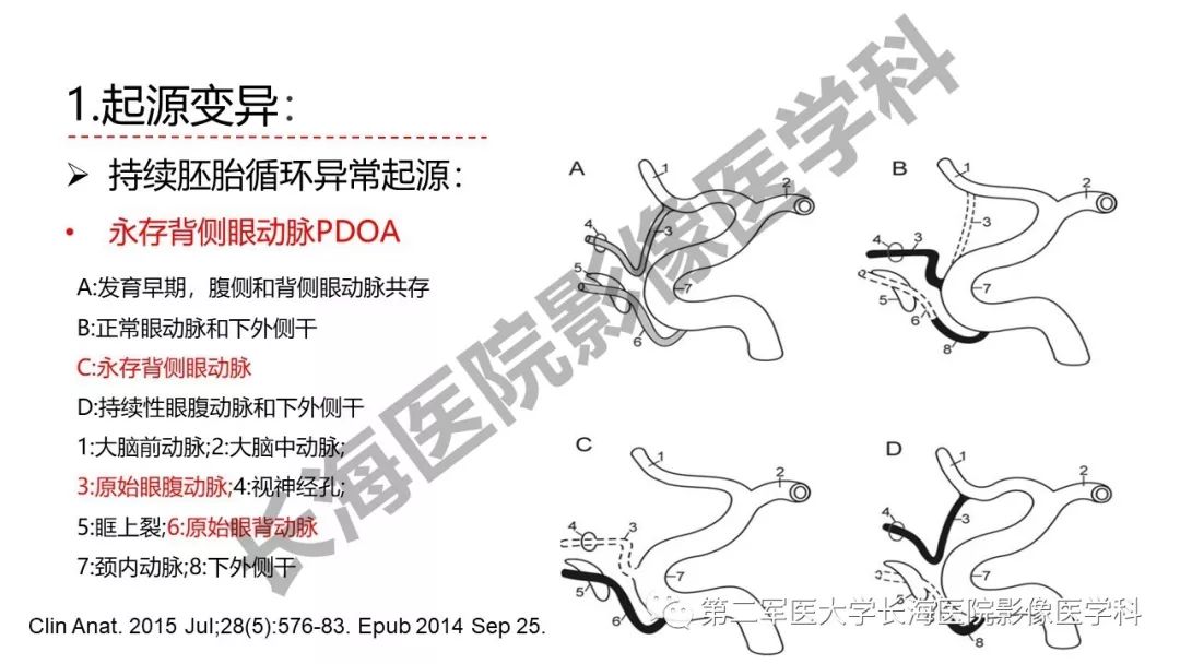 影像PPT - 【PPT】脑供血动脉常见变异-11
