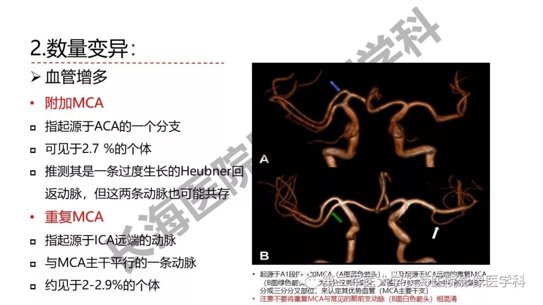 影像PPT - 【PPT】脑供血动脉常见变异-17