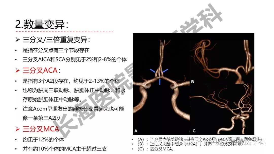 影像PPT - 【PPT】脑供血动脉常见变异-19