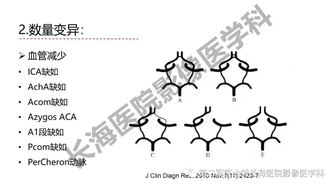 影像PPT - 【PPT】脑供血动脉常见变异-20