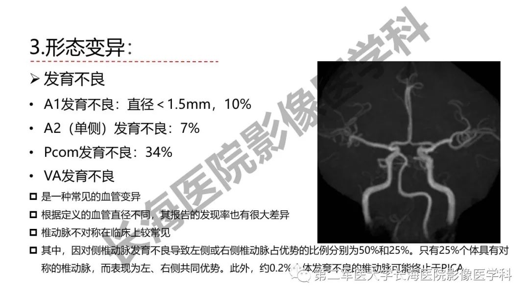 影像PPT - 【PPT】脑供血动脉常见变异-30