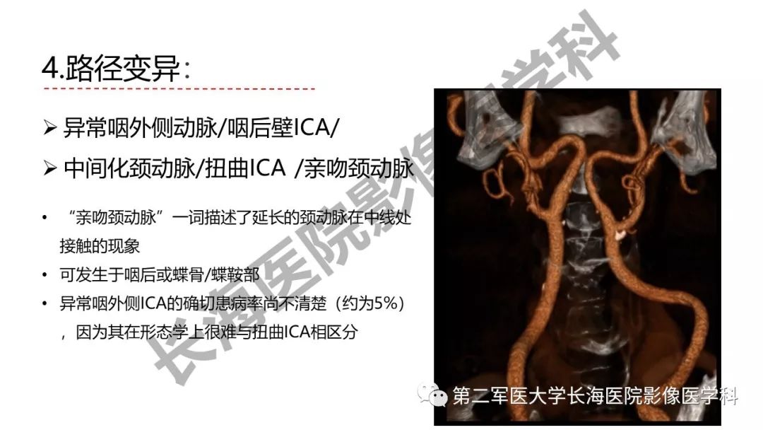 影像PPT - 【PPT】脑供血动脉常见变异-35
