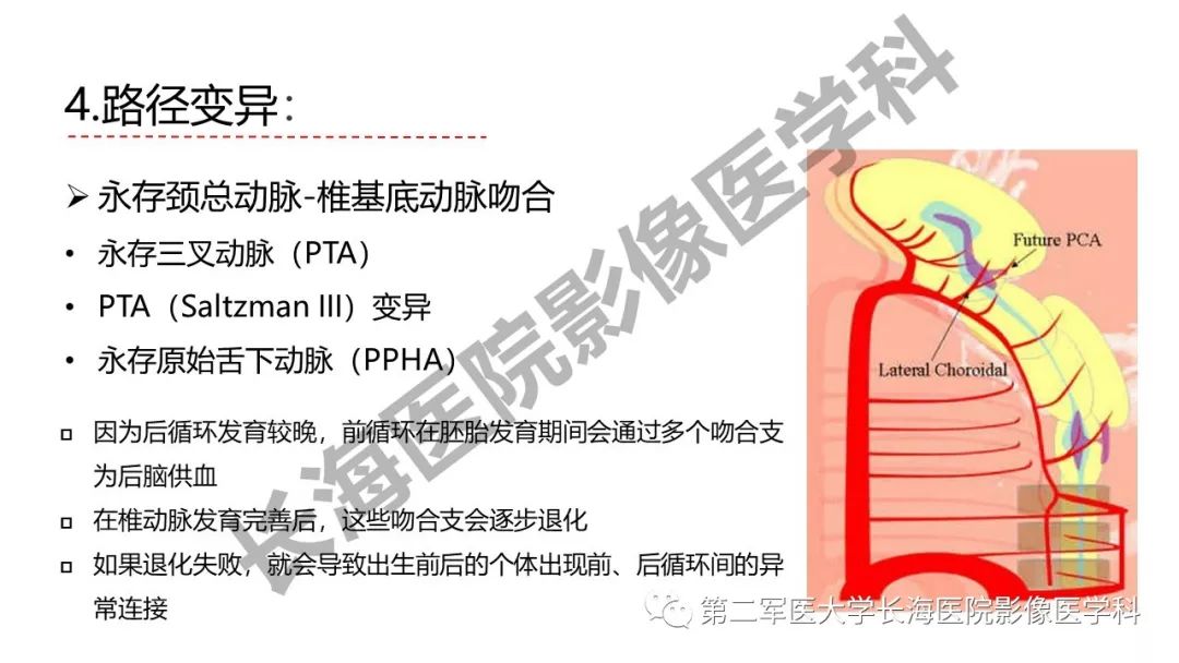 影像PPT - 【PPT】脑供血动脉常见变异-38