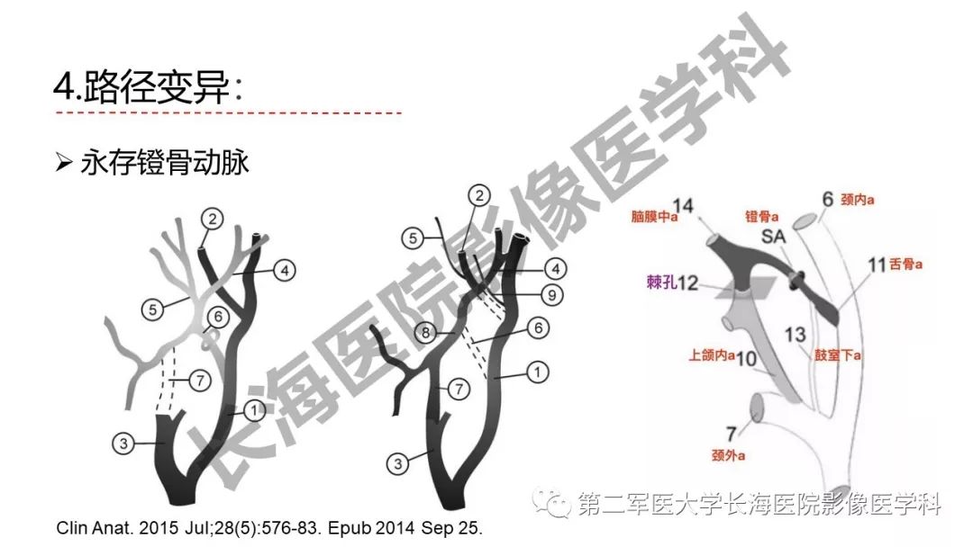影像PPT - 【PPT】脑供血动脉常见变异-42
