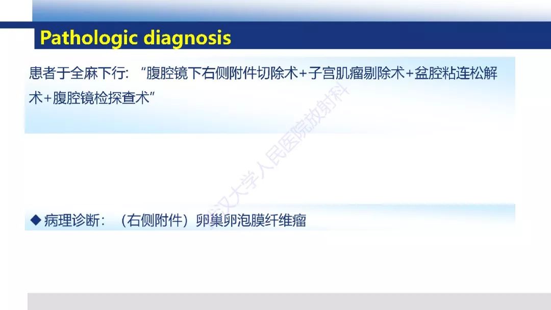 影像PPT - 【PPT】卵巢卵泡膜纤维瘤影像诊断-4