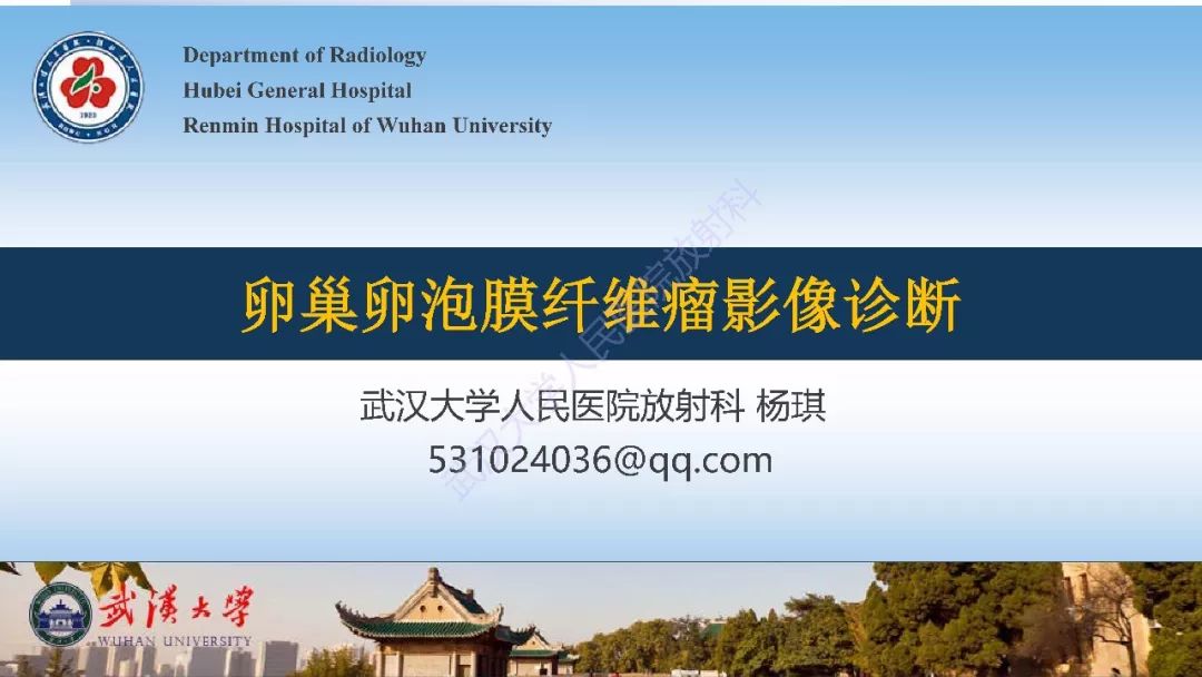 影像PPT - 【PPT】卵巢卵泡膜纤维瘤影像诊断-1