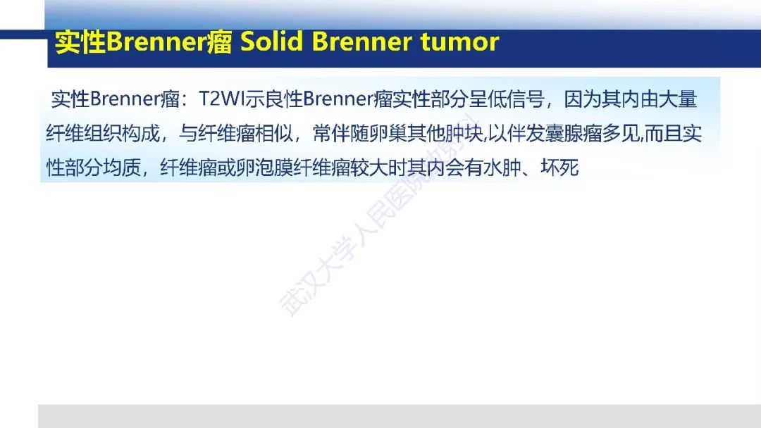 影像PPT - 【PPT】卵巢卵泡膜纤维瘤影像诊断-18