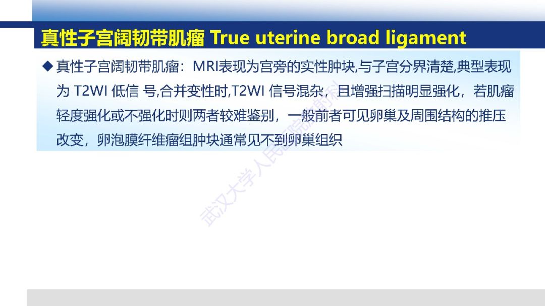 影像PPT - 【PPT】卵巢卵泡膜纤维瘤影像诊断-20