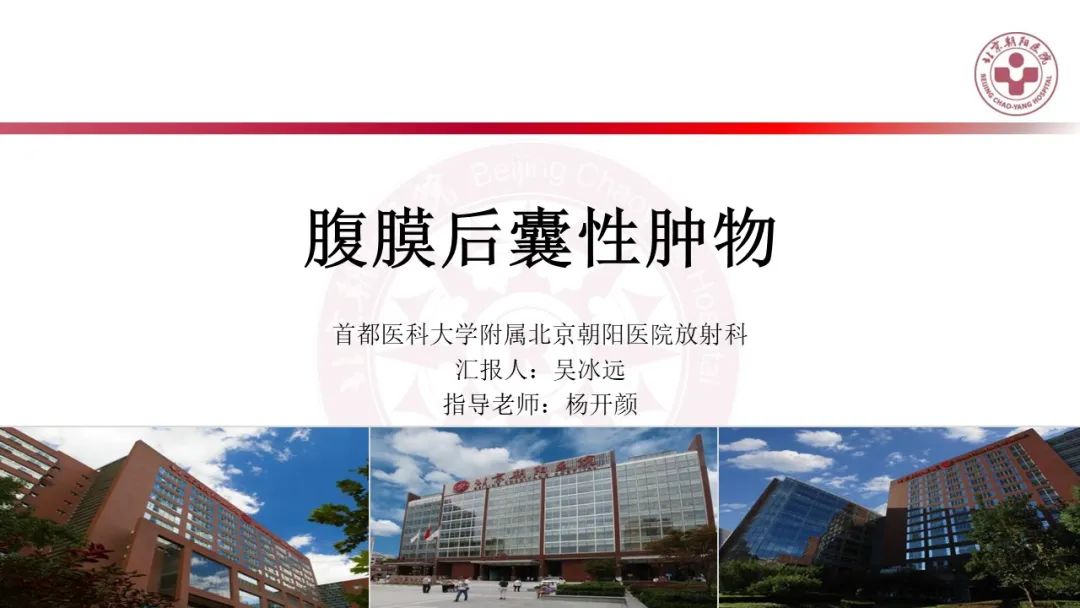 影像PPT - 【PPT】腹膜后囊性肿物-1