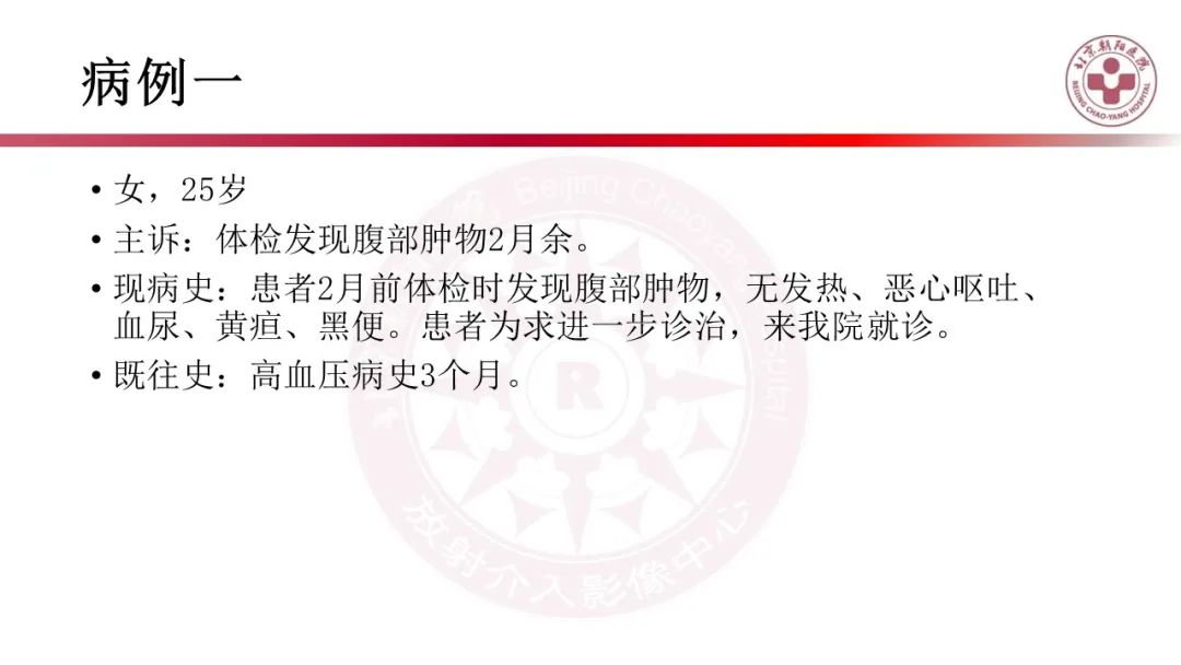 影像PPT - 【PPT】腹膜后囊性肿物-2
