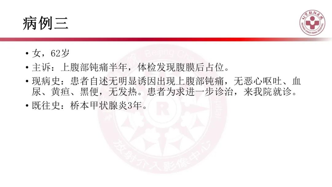 影像PPT - 【PPT】腹膜后囊性肿物-8