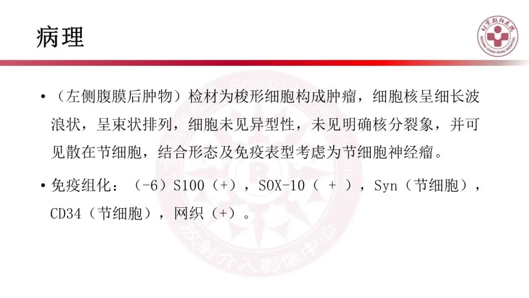 影像PPT - 【PPT】腹膜后囊性肿物-11