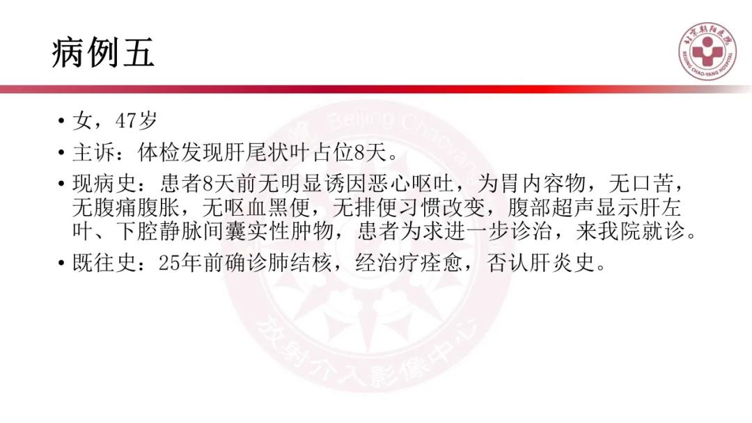 影像PPT - 【PPT】腹膜后囊性肿物-15