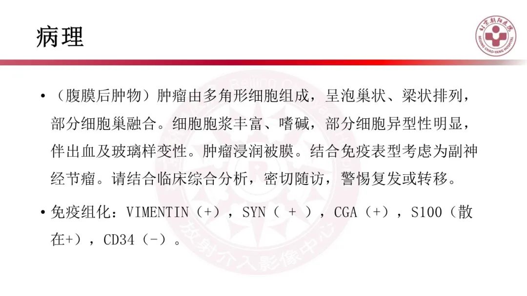 影像PPT - 【PPT】腹膜后囊性肿物-17