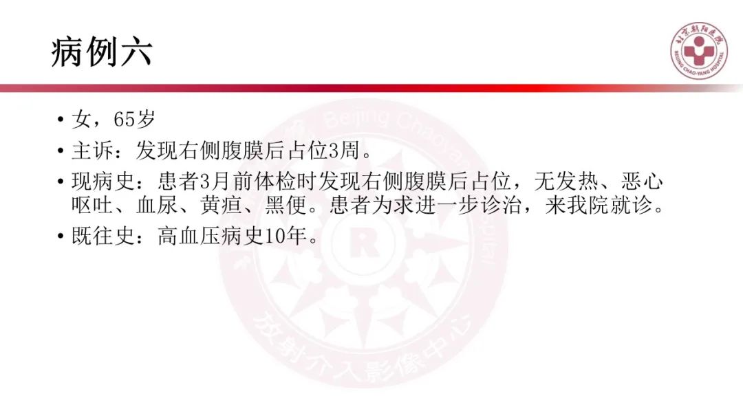 影像PPT - 【PPT】腹膜后囊性肿物-18