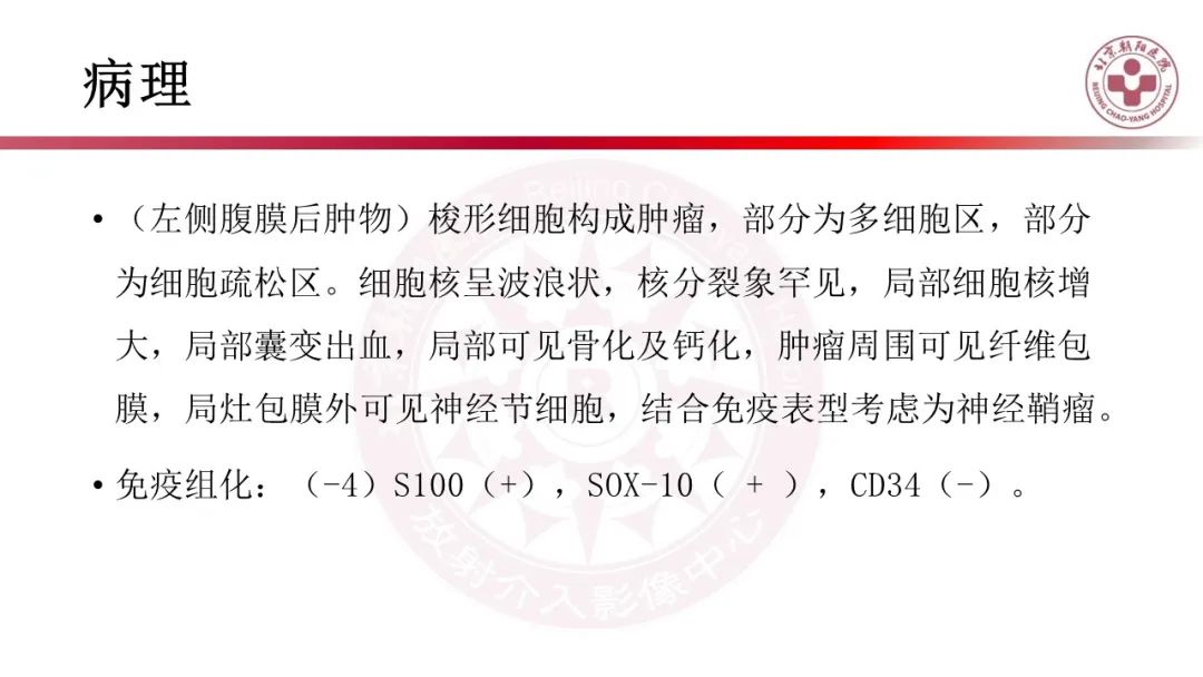 影像PPT - 【PPT】腹膜后囊性肿物-14