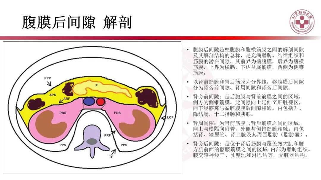 影像PPT - 【PPT】腹膜后囊性肿物-22