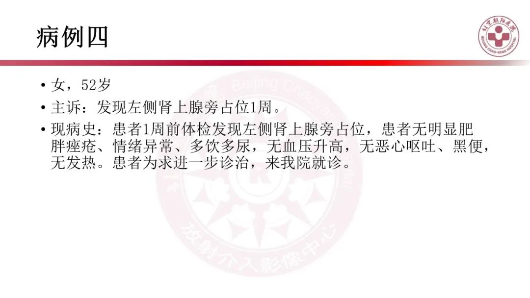 影像PPT - 【PPT】腹膜后囊性肿物-1