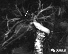 影像PPT - 【病例】IgG4相关性疾病1例CT及MR影像表现及文献复习-40 影像PPT - 【病例】IgG4相关性疾病1例CT及MR影像表现及文献复习-40