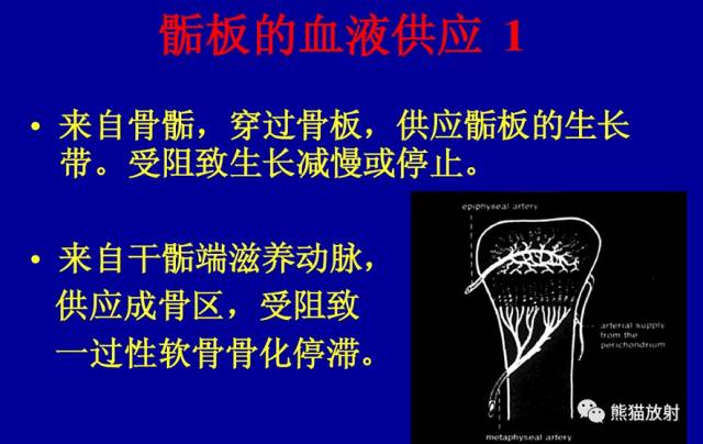 影像PPT - 骨骺损伤的分型及影像表现-3 影像PPT - 骨骺损伤的分型及影像表现-3
