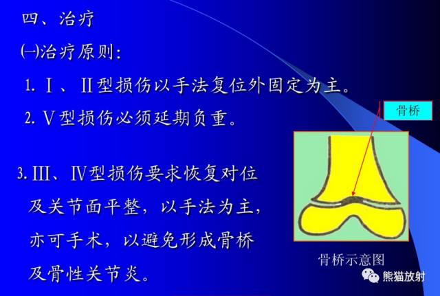 影像PPT - 骨骺损伤的分型及影像表现-21 影像PPT - 骨骺损伤的分型及影像表现-21