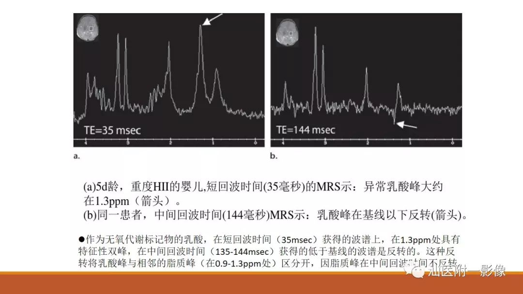 影像PPT - 【PPT】新生儿缺氧缺血性脑病磁共振诊断与损伤类型的分类建议-16
