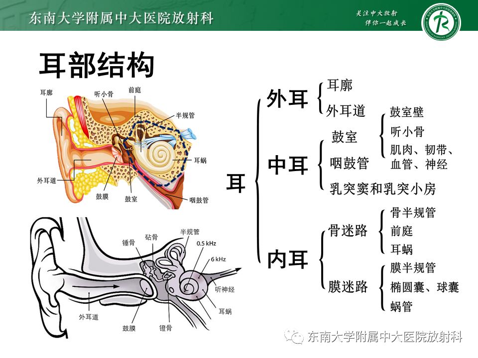 影像PPT - 【PPT】先天性耳发育畸形-5
