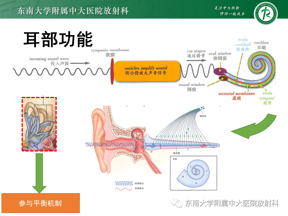 影像PPT - 【PPT】先天性耳发育畸形-6