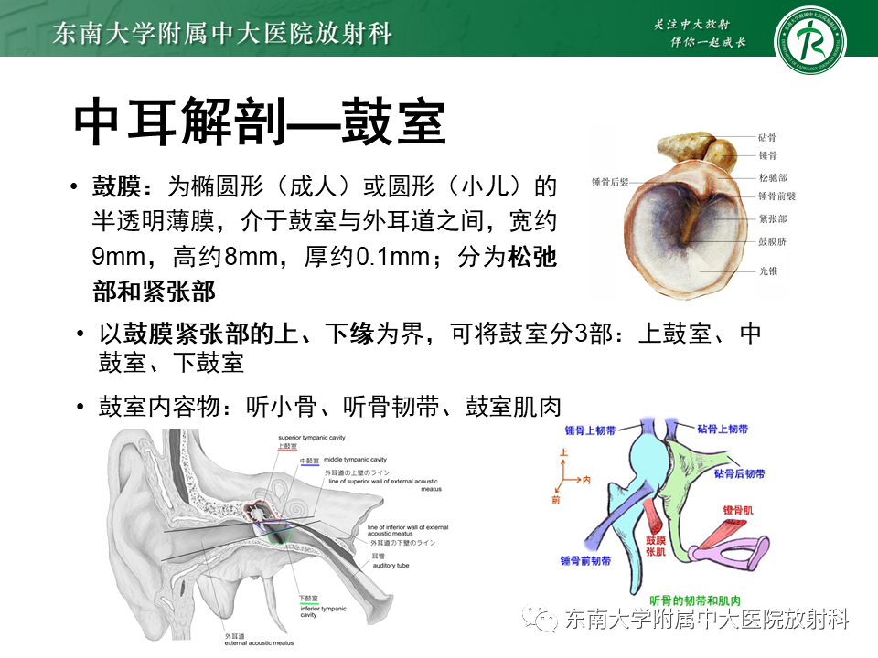 影像PPT - 【PPT】先天性耳发育畸形-8