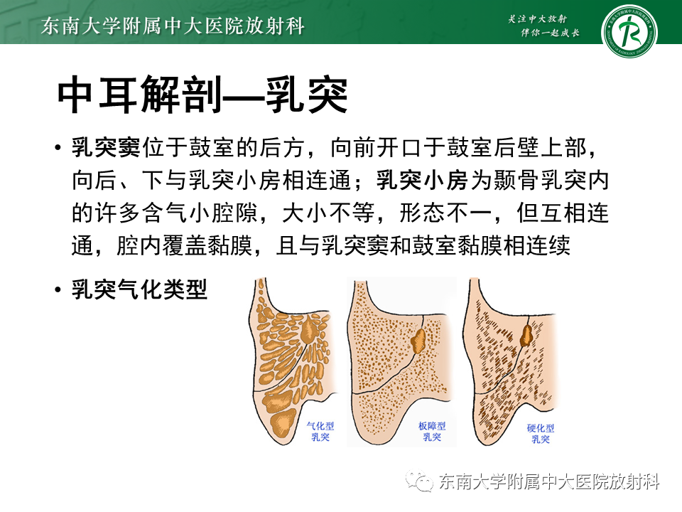 影像PPT - 【PPT】先天性耳发育畸形-10